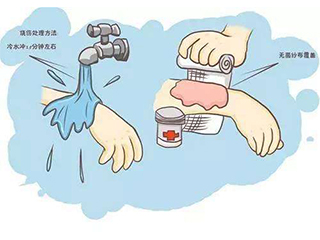 新科教育裝備分享在實驗室中發(fā)生各類燒傷的應急處理方法